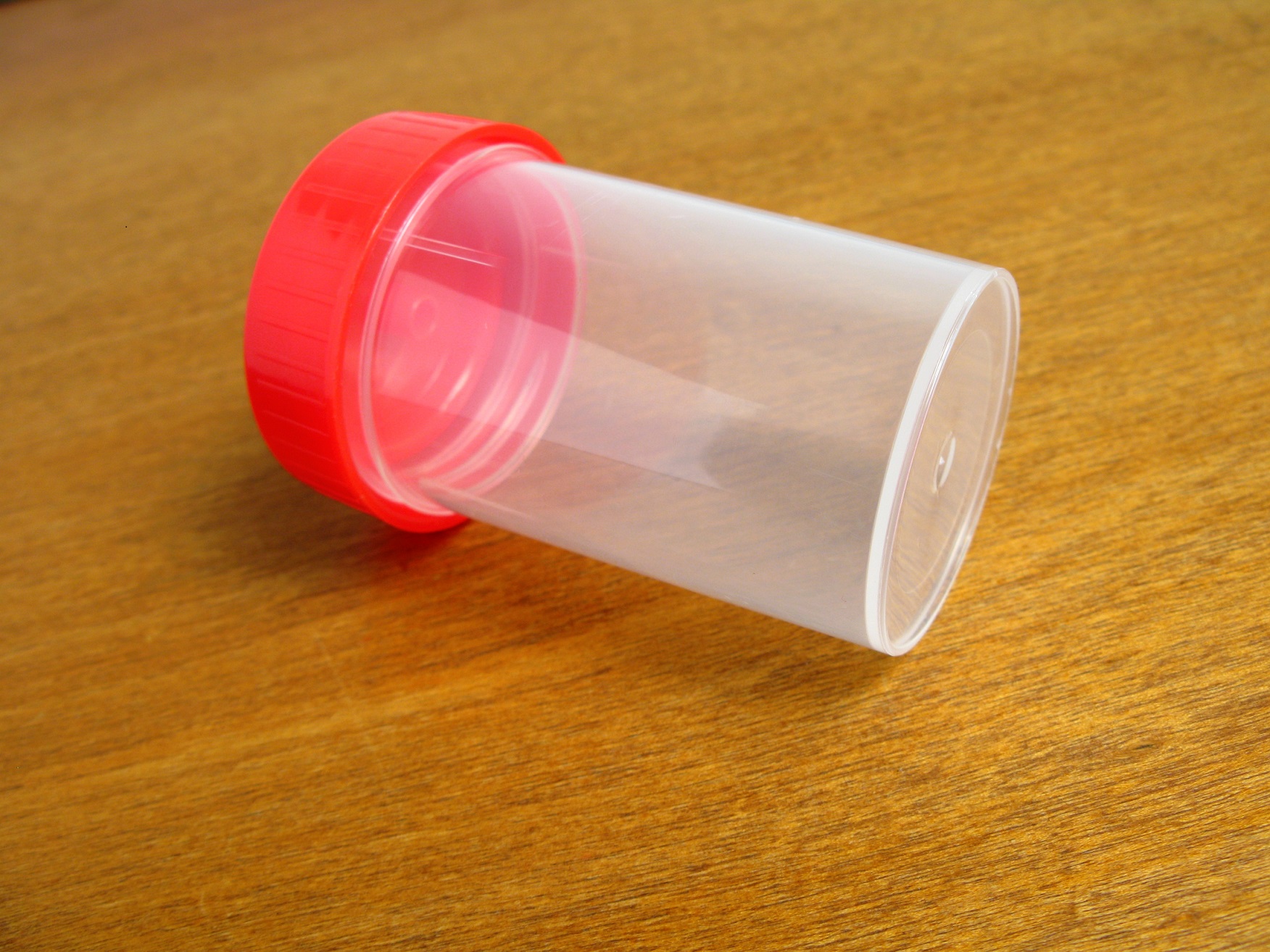 Understanding Proteinuria Does the Presence of Protein in Urine